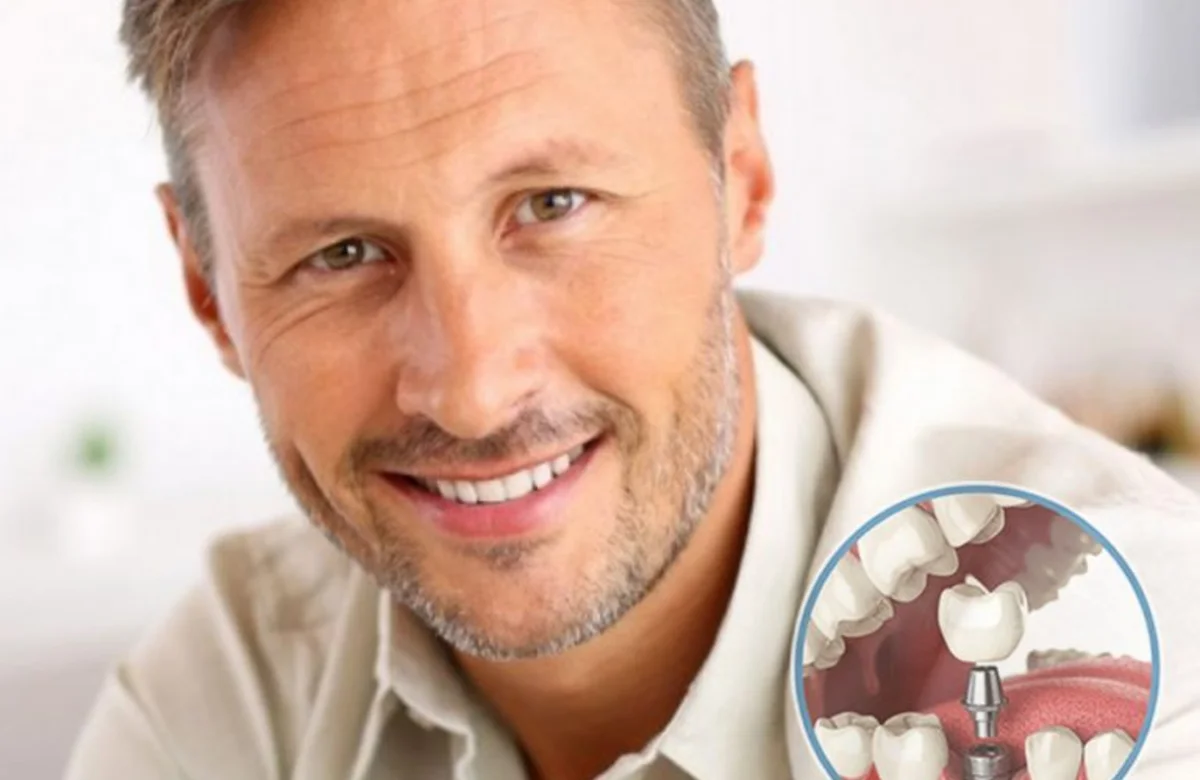 Patient smiling after multiple dental implants in Clapton, Hackney